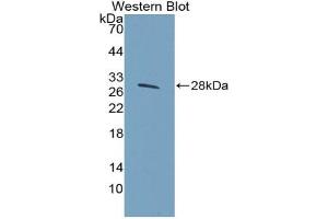 Western blot analysis of the recombinant protein. (HSPG2 antibody  (AA 4149-4391))
