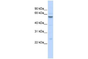 IGFALS antibody used at 1 ug/ml to detect target protein. (IGFALS antibody  (Middle Region))