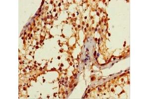 Immunohistochemistry of paraffin-embedded human testis tissue using ABIN7144155 at dilution of 1:100 (ANKDD1A antibody  (AA 272-490))