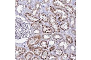 Immunohistochemical staining of human kidney with C12orf43 polyclonal antibody  shows strong cytoplasmic positivity in cells in tubules at 1:50-1:200 dilution. (C12orf43 antibody)