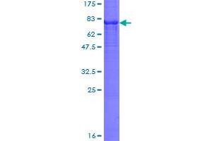 CYP7B1 Protein (AA 1-506) (GST tag)