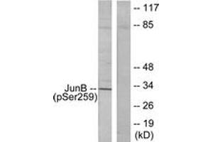 Western blot analysis of extracts from HeLa cells, using JunB (Phospho-Ser259) Antibody. (JunB antibody  (pSer259))