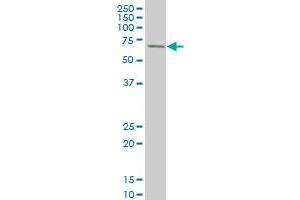 Western Blotting (WB) image for anti-Ribosomal Protein S6 Kinase, 70kDa, Polypeptide 1 (RPS6KB1) (AA 416-525) antibody (ABIN519894)