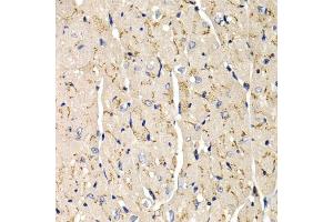 Immunohistochemistry of paraffin-embedded mouse heart using SFRP2 antibody (ABIN6131355, ABIN6147675, ABIN6147677 and ABIN6221030) at dilution of 1:200 (40x lens). (SFRP2 antibody  (AA 25-295))