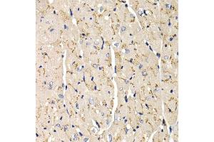 Immunohistochemistry of paraffin-embedded mouse heart using SFRP2 antibody (ABIN6131355, ABIN6147675, ABIN6147677 and ABIN6221030) at dilution of 1:200 (40x lens). (SFRP2 antibody  (AA 25-295))