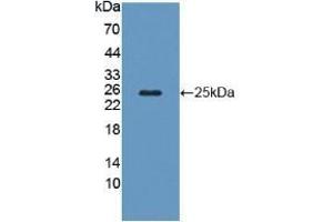 Detection of Recombinant CAPS, Human using Polyclonal Antibody to Calcyphosine (CAPS) (Calcyphosine antibody  (AA 1-189))