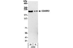 Western Blotting (WB) image for anti-CD45RO (CD45RO) antibody (ABIN7449553) (CD45RO antibody)