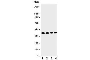 Western blot testing of EIF2S1 antbody; Lane 1: COLO320;  2: CEM;  3: Raji;  4: HT1080 cell lysate.