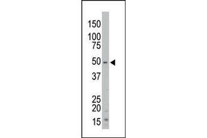 The anti-STK35 Pab is used in Western blot to detect STK35 in mouse kidney tissue lysate. (STK35 antibody  (Middle Region))