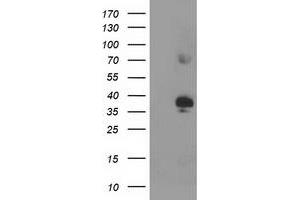 HEK293T cells were transfected with the pCMV6-ENTRY control (Left lane) or pCMV6-ENTRY SIRT6 (Right lane) cDNA for 48 hrs and lysed. (SIRT6 antibody  (AA 88-352))