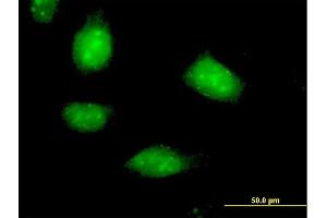 Immunofluorescence of purified MaxPab antibody to SESN1 on HeLa cell. (SESN1 antibody  (AA 1-551))