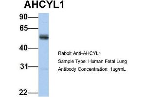 Host: Rabbit Target Name: AHCYL1 Sample Type: Human Fetal Lung Antibody Dilution: 1. (AHCYL1 antibody  (N-Term))