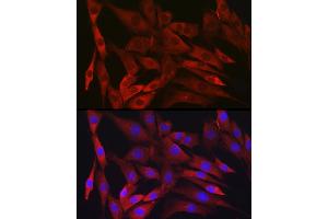 Immunofluorescence analysis of NIH/3T3 cells using IKKβ Rabbit mAb (ABIN7267873) at dilution of 1:100 (40x lens). (IKBKB antibody)