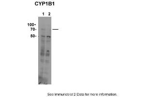 Sample type: 1. (CYP11B1 antibody  (C-Term))