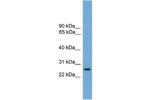 WB Suggested Anti-LRRC3 Antibody Titration:  0. (LRRC3 antibody  (Middle Region))