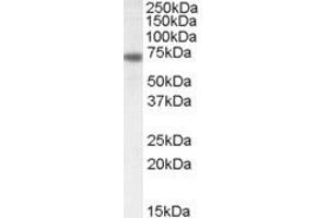Western Blotting (WB) image for anti-Netrin 1 (NTN1) (C-Term) antibody (ABIN2464806) (Netrin 1 antibody  (C-Term))