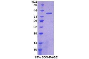 SDS-PAGE (SDS) image for Nesfatin-1 (NES1) (AA 26-106) protein (His tag,GST tag) (ABIN2123356)