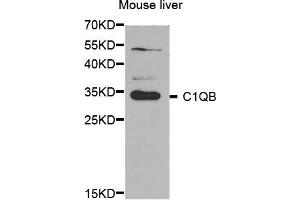Western Blotting (WB) image for anti-Complement Component 1, Q Subcomponent, B Chain (C1QB) antibody (ABIN1876527) (C1QB antibody)