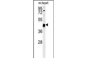 Western blot analysis in mouse heart tissue lysates (15ug/lane). (TINAGL1 antibody  (C-Term))