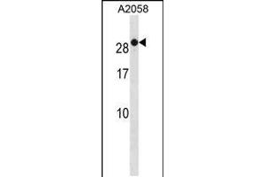 Western blot analysis in A2058 cell line lysates (35ug/lane). (RAB7B antibody  (C-Term))