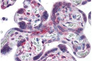 Human Placenta: Formalin-Fixed, Paraffin-Embedded (FFPE) (RPS7 antibody  (AA 95-195))