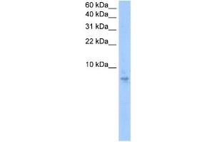 Septin 6 antibody used at 0. (Septin 6 antibody  (N-Term))