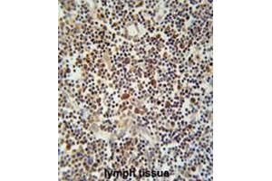 CLM1 Antibody (N-term) immunohistochemistry analysis in formalin fixed and paraffin embedded human lymph tissue followed by peroxidase conjugation of the secondary antibody and DAB staining.
