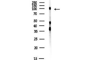 Western blot analysis of lysates from EC304 cells(heat-shock,45 min treatment), using SCYL1 Antibody at 1/1000 dilution.