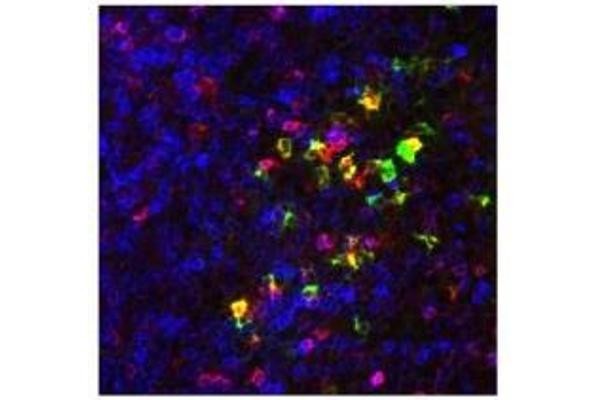 CCR9 antibody  (AA 3-22)