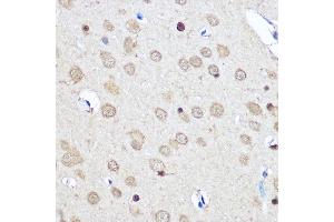 Immunohistochemistry of paraffin-embedded Rat brain using CNOT7 Rabbit pAb (ABIN6127563, ABIN6138783, ABIN6138784 and ABIN6224834) at dilution of 1:50 (40x lens). (CNOT7 antibody  (AA 90-160))