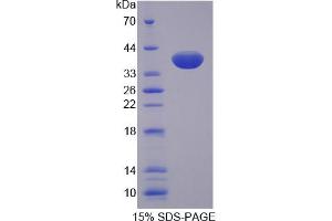 Image no. 1 for Secreted Frizzled-Related Protein 1 (SFRP1) (AA 32-314) protein (His tag) (ABIN3209954)