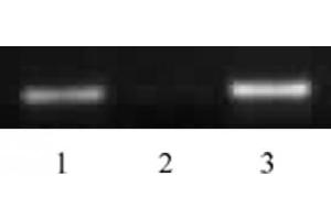 Histone H4 acetyl Lys5 antibody tested by ChIP. (Histone H4 antibody  (acLys5))