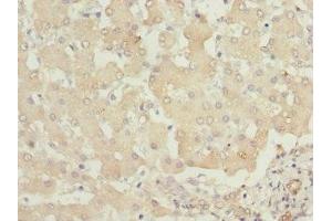 Immunohistochemistry of paraffin-embedded human liver tissue using ABIN7163408 at dilution of 1:100 (PHKB antibody  (Regulatory Subunit beta))