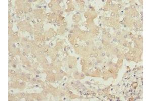 Immunohistochemistry of paraffin-embedded human liver tissue using ABIN7163408 at dilution of 1:100