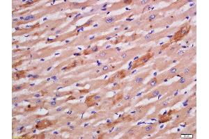 Formalin-fixed and paraffin embedded rat heart labeled with Rabbit Anti-Sarcomeric Alpha Actinin Polyclonal Antibody, Unconjugated  at 1:200 followed by conjugation to the secondary antibody and DAB staining
