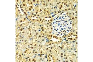 Immunohistochemistry (Paraffin-embedded Sections) (IHC (p)) image for anti-Heterogeneous Nuclear Ribonucleoprotein A2/B1 (HNRNPA2B1) (AA 1-180) antibody (ABIN3021593)