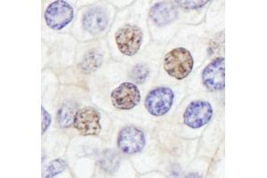 anti-GTF2IRD/TFII-IRD1 (AA 650-700) antibody