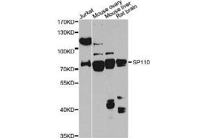 Western blot analysis of extracts of various cell lines, using SP110 antibody (ABIN6290941) at 1:1000 dilution.