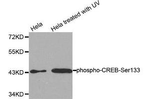 Western Blotting (WB) image for anti-cAMP Responsive Element Binding Protein 1 (CREB1) (pSer133) antibody (ABIN1681491) (CREB1 antibody  (pSer133))