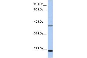WB Suggested Anti-HDDC3 Antibody Titration: 0. (HDDC3 antibody  (Middle Region))