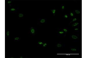 Immunofluorescence of monoclonal antibody to MEOX1 on HeLa cell. (MEOX1 antibody  (AA 82-170))