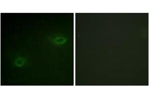 Immunofluorescence analysis of HeLa cells, using Syndecan4 (Ab-179) Antibody. (SDC4 antibody  (AA 145-194))