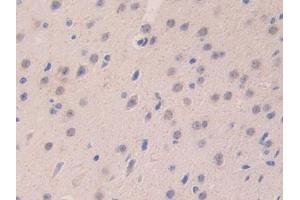 Detection of LAMa4 in Mouse Cerebrum Tissue using Polyclonal Antibody to Laminin Alpha 4 (LAMa4) (LAMa4 antibody  (AA 745-940))