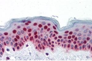 Human Skin: Formalin-Fixed, Paraffin-Embedded (FFPE) (PTBP1 antibody  (AA 45-145))