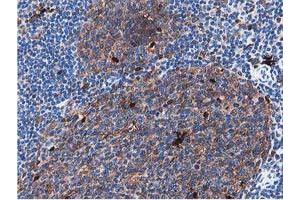 Image no. 8 for anti-Sequestosome 1 (SQSTM1) antibody (ABIN1499988) (SQSTM1 antibody)