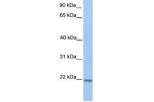 WB Suggested Anti-ZNF548 Antibody Titration:  0.