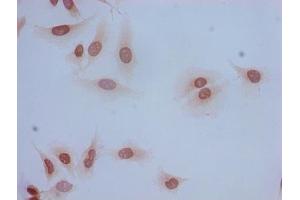 Immunocytochemistry analysis of Hela cells using ABIN7139185 at dilution of 1:100 (HIST1H2BB antibody  (acLys5))