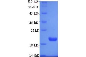 SDS-PAGE (SDS) image for Prune Exopolyphosphatase (PRUNE) (AA 1-168) protein (His tag) (ABIN4974664) (PRUNE Protein (AA 1-168) (His tag))