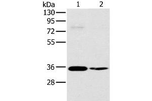 Western Blot analysis of 293T and skov3 cell using OTUB1 Polyclonal Antibody at dilution of 1:570 (OTUB1 antibody)
