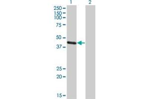 Western Blot analysis of MAGEA4 expression in transfected 293T cell line by MAGEA4 polyclonal antibody (A01). (MAGEA4 antibody  (AA 98-171))
